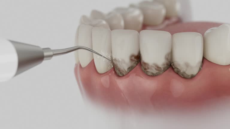 Trusted Emergency Dentist service in Lynn, MA - Dentist Open Now